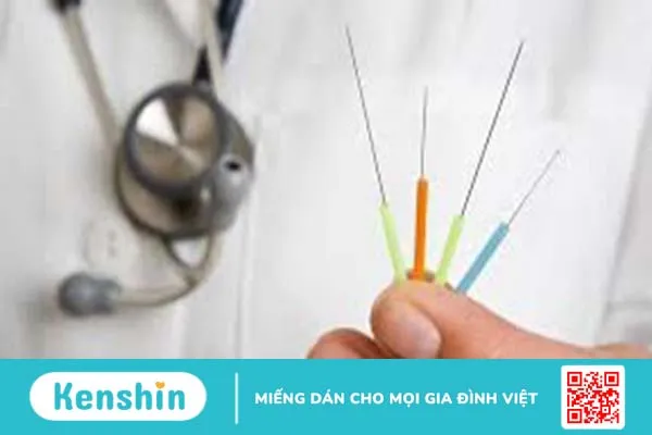 Điện châm điều trị liệt dây thần kinh số 7 và cách phòng tránh bệnh này