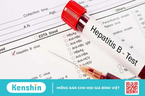 Định lượng HBV-DNA âm tính có ý nghĩa như thế nào?