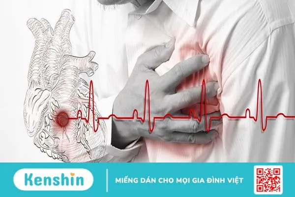 Đột quỵ do tắc mạch từ tim nguy hiểm không? Nguyên nhân, triệu chứng và chẩn đoán