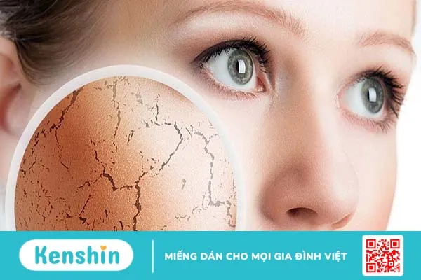 Dùng retinol bị lên mụn xử trí như thế nào?