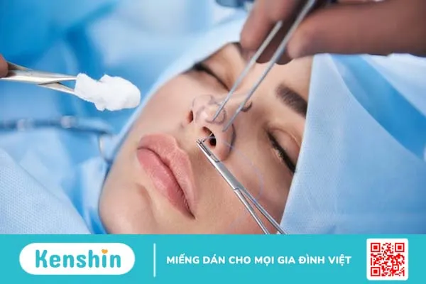 Giải phẫu mũi và các bệnh về mũi thường gặp