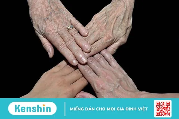 Giãn tĩnh mạch tay là gì? Nguyên nhân, cách điều trị và biện pháp phòng tránh