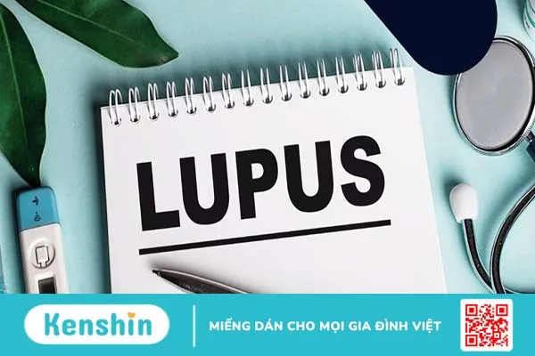 Góc giải đáp: Bệnh lupus ban đỏ hệ thống có lây không?