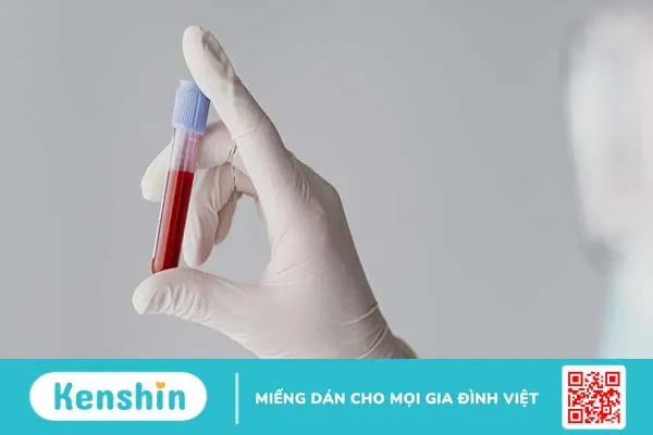 Góc sức khỏe: Những điều cần biết về chỉ số xét nghiệm marker ung thư