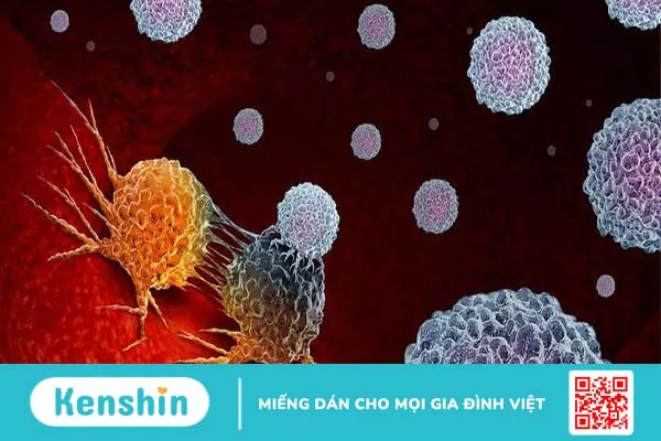 Hạch di căn carcinoma có nguy hiểm không?