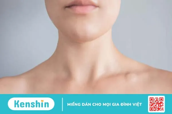 Hạch troisier là gì? Hạch nằm ở đâu và có gây nguy hiểm không?