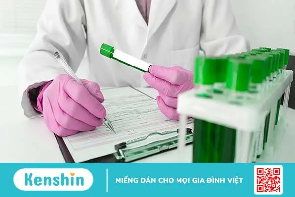 Helicobacter pylori Ag test nhanh là gì? Các phương pháp xét nghiệm phổ biến nhất