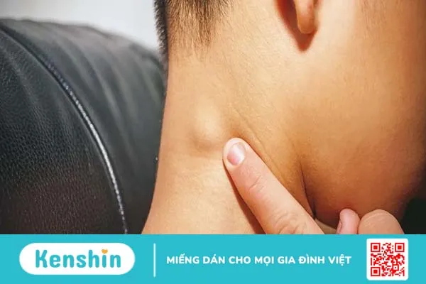 Hiện tượng nổi hạch ở cổ bên phải và đau nhức có nguy hiểm không?