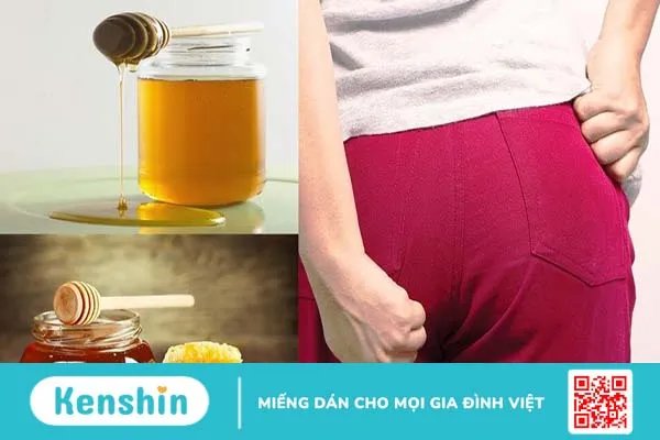 Hướng dẫn cách chữa bệnh trĩ bằng mật ong