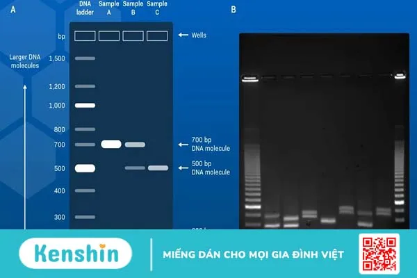 Hướng dẫn cách đọc kết quả điện di DNA