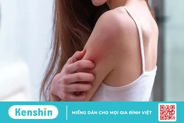 Hướng dẫn điều trị viêm mô tế bào đúng cách