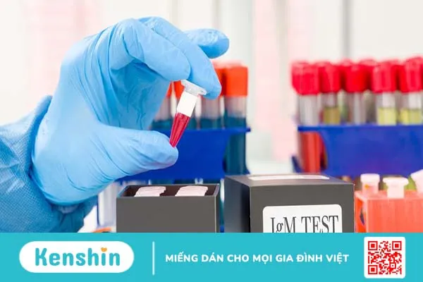 IgM là gì? Ý nghĩa của nó trong xét nghiệm chuyên khoa