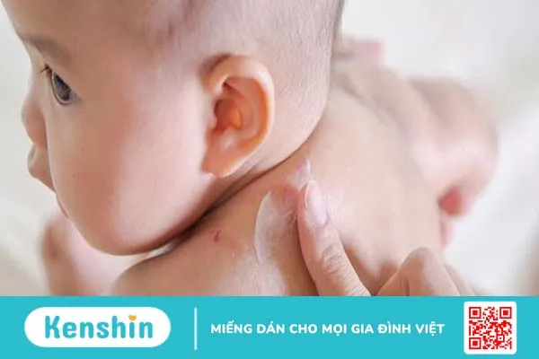 Kem em bé có tác dụng gì?