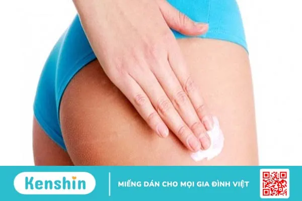 Kem trị rạn da mông loại nào tốt?