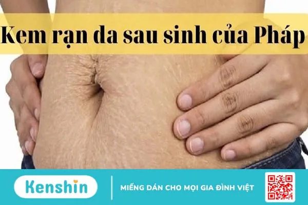 Kem trị rạn da sau sinh của Pháp loại nào tốt?