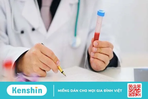 Kết quả xét nghiệm Adenosine Deaminase có ý nghĩa gì?