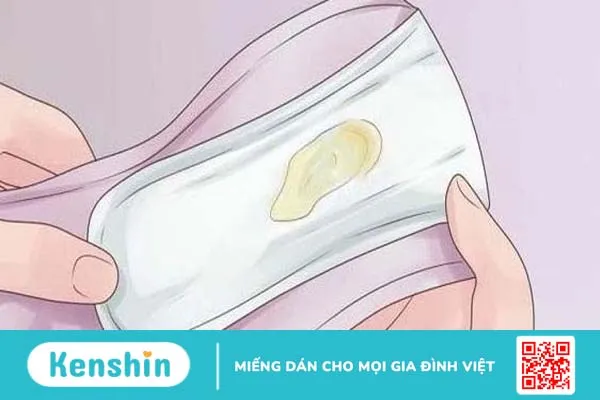 Khí hư màu vàng là dấu hiệu bệnh gì?