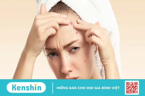 Không nặn mụn có tự hết không?