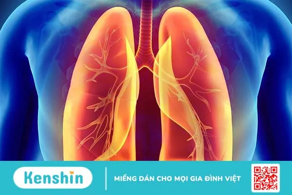 Kỹ thuật Cell Block trong chẩn đoán tràn dịch màng phổi