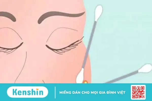 Lưu ý khi lấy nhân mụn tại nhà