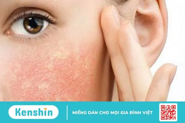 Mẹo chăm sóc da trước, trong và sau khi xạ trị