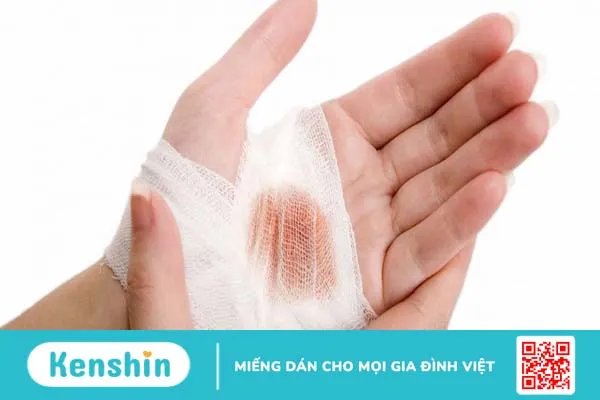 Một số lưu ý cần biết khi chăm sóc vết thương hở tại nhà