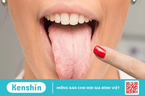 Nấm họng ở người lớn: Đối tượng nào có nguy cơ nhiễm nấm cao?