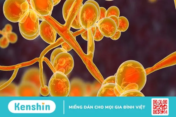 Nên ăn và kiêng gì khi có nấm candida ở khoang miệng?