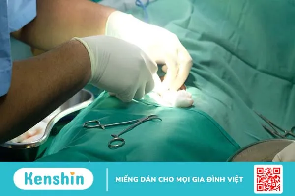 Nên cắt bao quy đầu ở đâu tốt và uy tín nhất TP. Hồ Chí Minh?