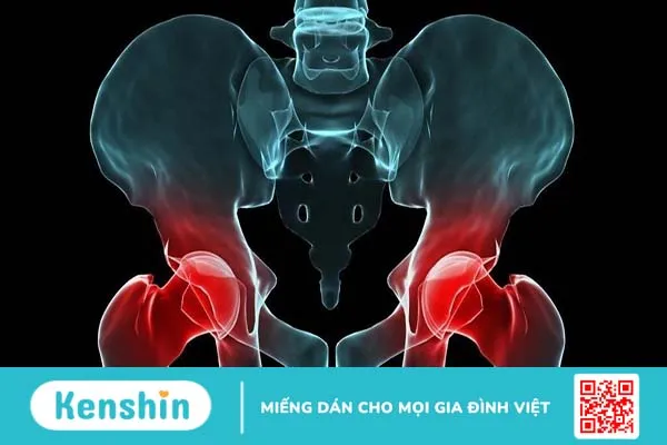 Nghiệm pháp patrick: Cách thực hiện và ý nghĩa chẩn đoán bệnh