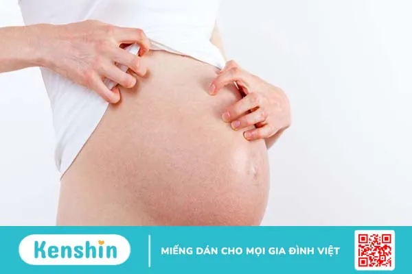 Ngứa khi mang thai: Nguyên nhân và cách điều trị