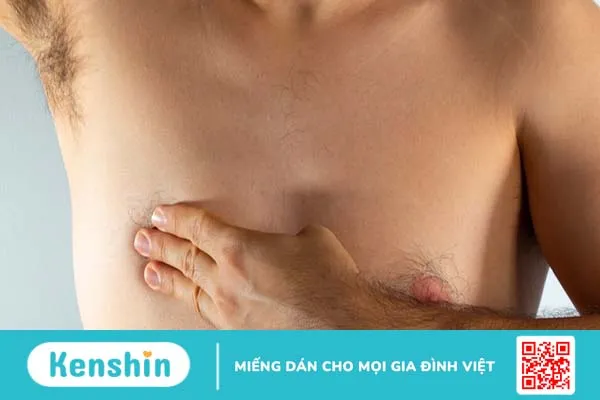 Nguyên nhân gây nổi hạch ở nách trái nam giới và phương pháp xử trí mà bạn nên biết