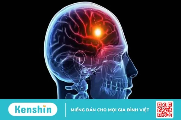 Nguyên nhân và triệu chứng của tình trạng thiếu oxy lên não