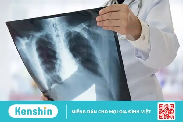 Nhận biết dày dính màng phổi trên hình ảnh chụp X quang