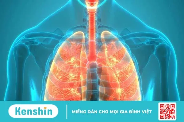 Nhiễm trùng đường hô hấp dưới: Viêm phế quản