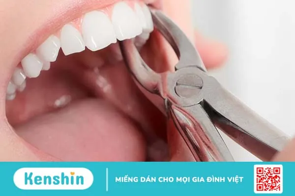 Nhổ răng xong có đánh răng được không?