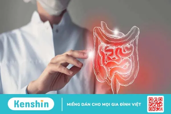 Những bệnh nhân viêm trực tràng uống thuốc gì?