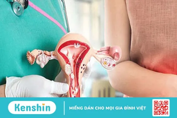 Những chia sẻ về phòng ngừa viêm lộ tuyến cổ tử cung