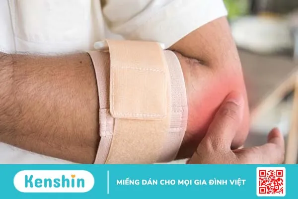 Những điều cần biết về viêm điểm bám gân lồi cầu ngoài xương cánh tay