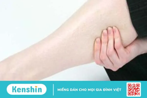 Nổi hạch ở bắp chân là bệnh gì? Khi nào cần phải đi thăm khám bác sĩ?