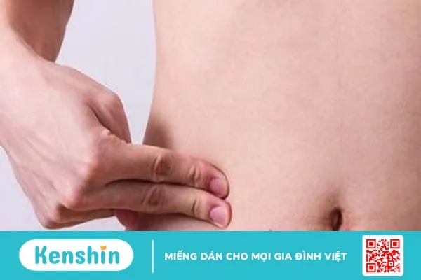 Nổi hạch ở bụng: Nguyên nhân, dấu hiệu nhận biết và biện pháp phòng tránh