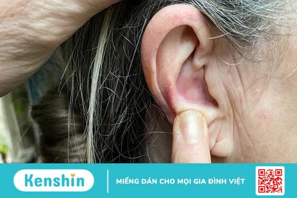 Nổi hạch ở vành tai do nguyên nhân gì? Biện pháp phòng ngừa thế nào?