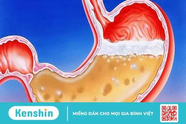 Phản xạ ruột dạ dày và những điều bạn nên biết