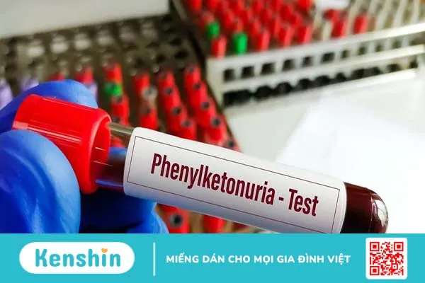 Phenylketone niệu (PKU): Nguyên nhân, triệu chứng và điều trị