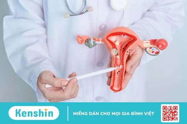 Phụ nữ mắc u xơ tử cung có sinh thường được không?