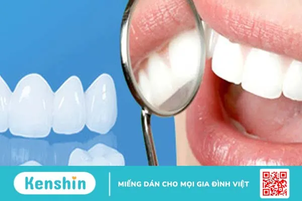 Phục hình răng là gì? Có những phương pháp phục hình răng nào?