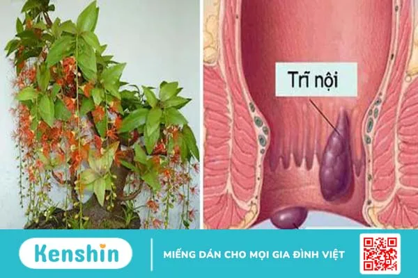 Phương pháp chữa bệnh trĩ bằng cây lộc vừng an toàn và hiệu quả