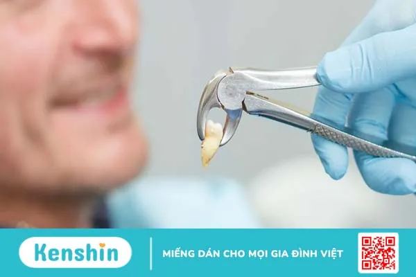 Quá trình lành thương sau nhổ răng diễn ra như thế nào?