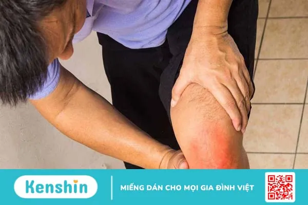 Rách sụn chêm nên ăn gì? Lợi ích của chế độ dinh dưỡng cho các bệnh về xương khớp