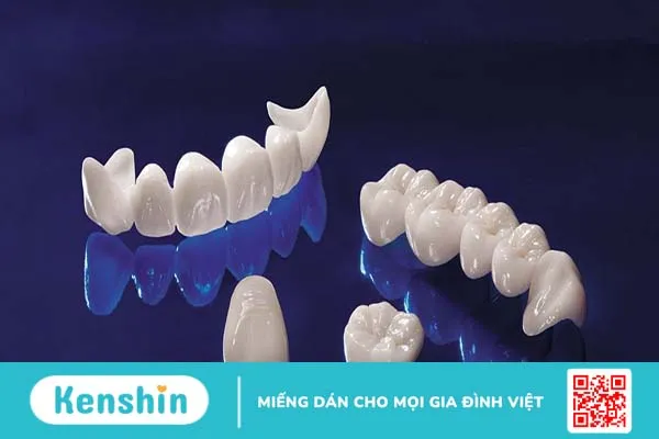 Răng toàn sứ là gì? Một số loại răng toàn sứ phổ biến